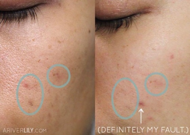 SERUM KLAIRS MIDNIGHT BLUE