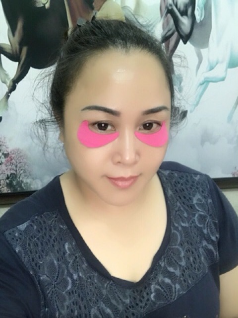 Miếng dán tan bọng mắt