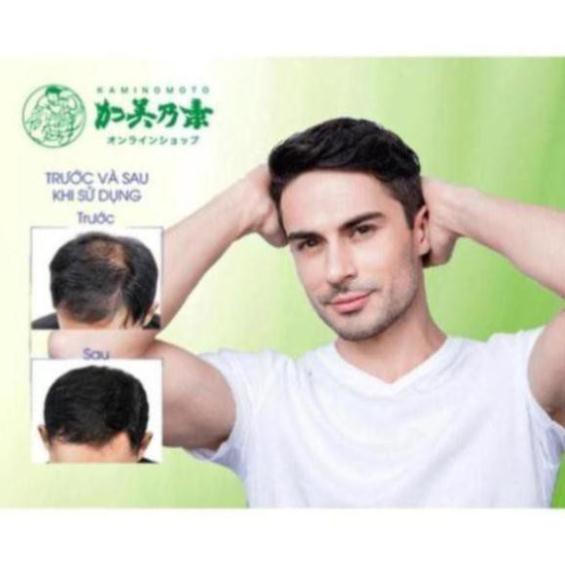 Thuốc ngăn rụng, kích mọc tóc siêu mạnh Higher Strength Kaminomoto Nhật Bản 200ml | BigBuy360 - bigbuy360.vn