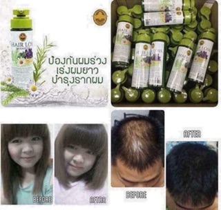DẦU GỘI KÍCH THÍCH MỌC TÓC