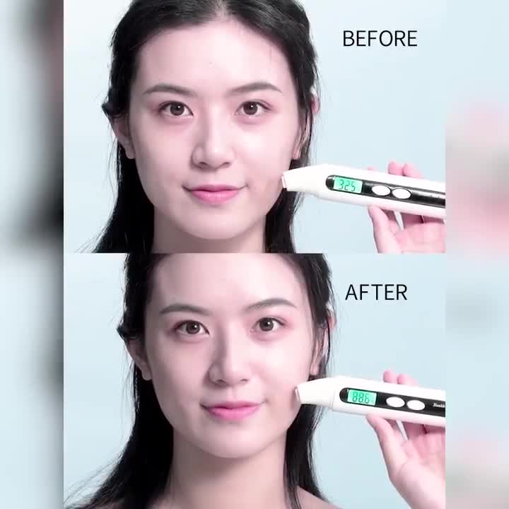 Gel Tẩy Tế Bào Chết Da Mặt Matcha Trà Xanh Laikou Peeling Gel 60g | BigBuy360 - bigbuy360.vn