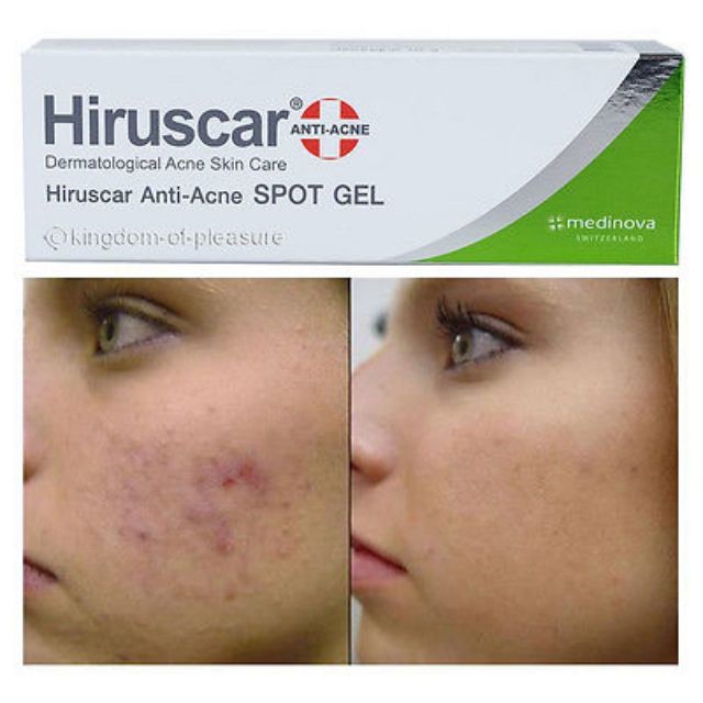 Hiruscar Gel Hỗ Trợ Giảm Mụn Hiruscar Anti - Acne Spot Gel  10g