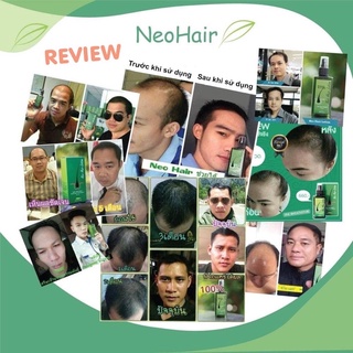 MỌC TÓC Thái Lan Neo Hair Lotion