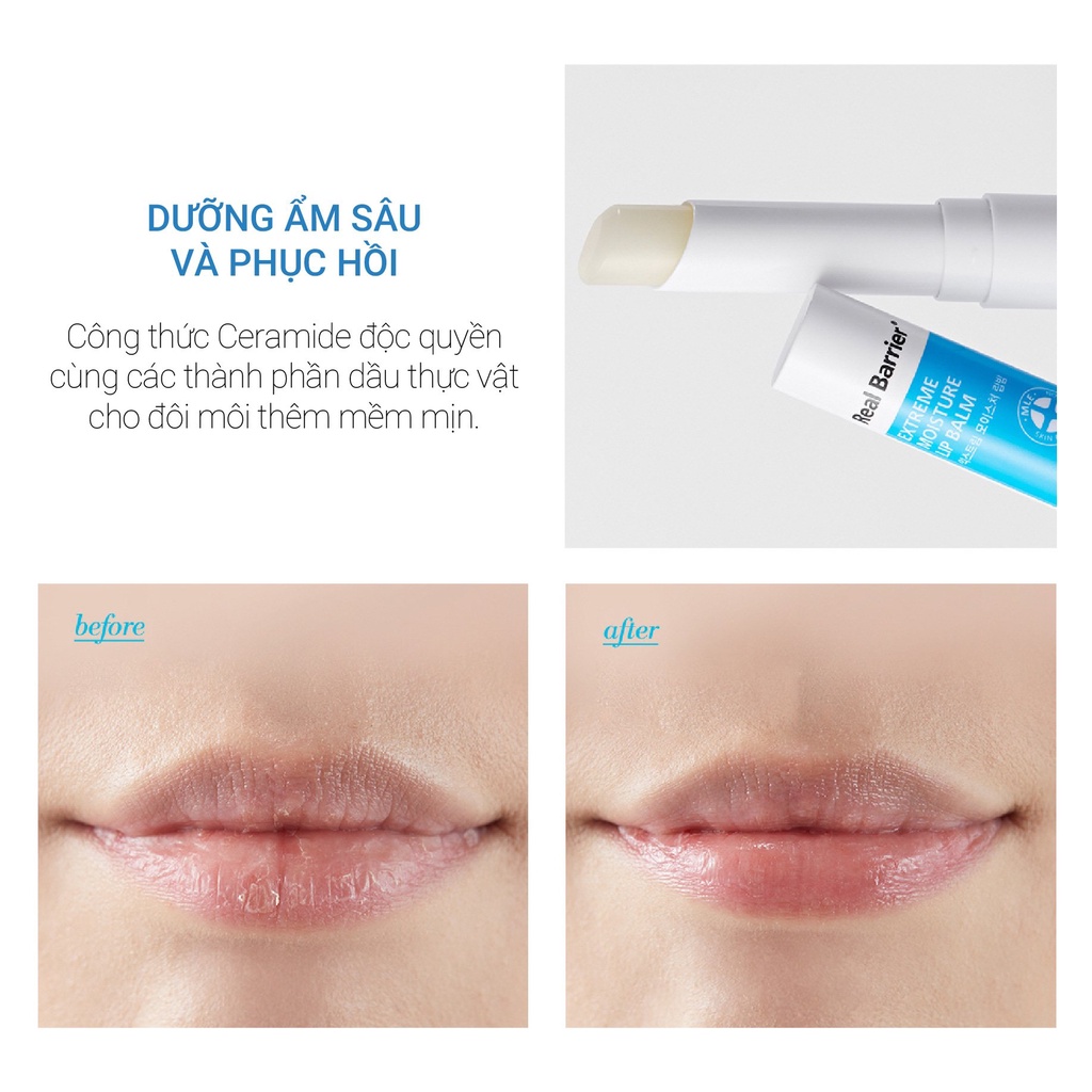 Son dưỡng cấp ẩm sâu Real Barrier Extreme Moisture Lip Balm 3.3g