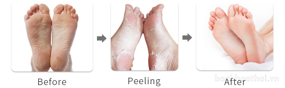 [MỚI] Mặt nạ bàn châŋ Foot peeling mask + Q10 Thái Lan