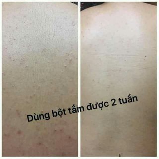 Bột tắm Linhcen