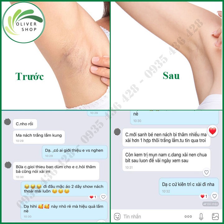 Khử Hôi Nách Thâm Nách ⚡SIÊU TO+QUÀ TẶNG⚡ Kem Cô Bơ Size Lớn Siêu Tiết Kiệm Chính Hãng 100%