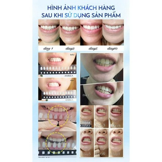 Combo 2 Hộp miếng dán trắng răng Anriea than tre