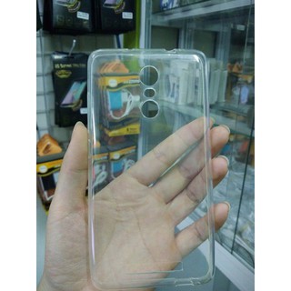 Ốp dẻo Xiaomi Redmi Note 3