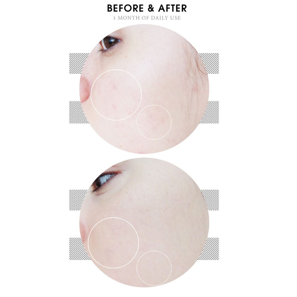 Tẩy Da Chết Cosrx Hóa Học Làm Trắng Da, Giảm Nhăn AHA 7 Whitehead Power Liquid 100ml | BigBuy360 - bigbuy360.vn