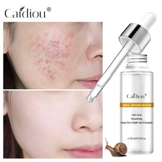 Serum Chiết Xuất Ốc Sên Hỗ Trợ Giảm Mụn Và Làm Trẻ Hóa Làn Da 15ml