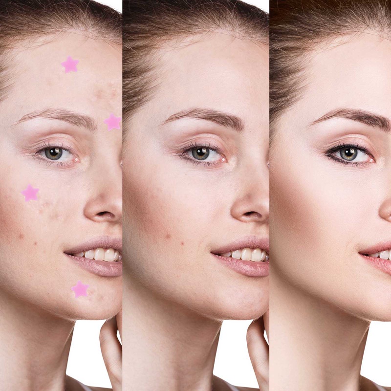 Miếng Dán Trị Mụn Dạng Gel Nước Jjiuad Họa Tiết Ngôi Sao Hoạt Hình