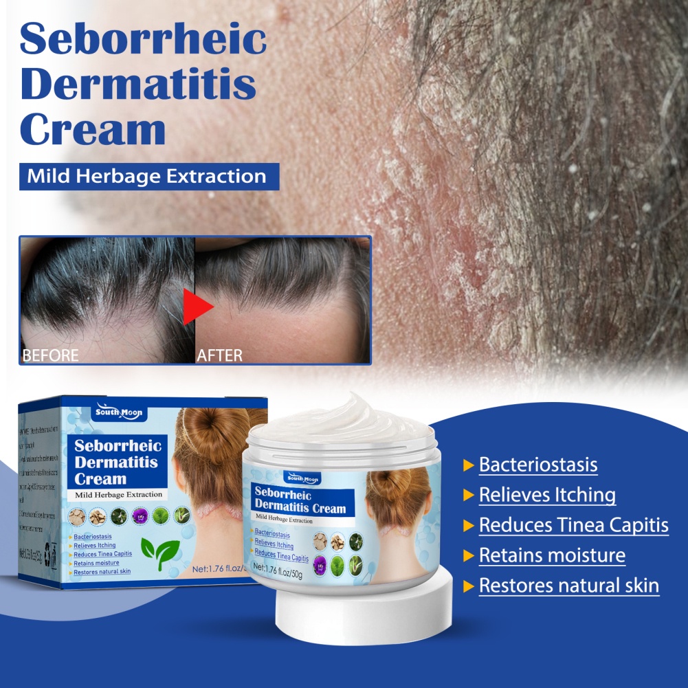 Kem Dưỡng Da Mặt South Moon Seborrheic Hỗ trợ giảm mụn Trứng Cá Ngứa Phục Hồi Da
