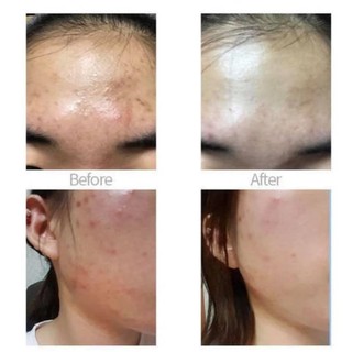 Kem Chấm Mụn Cellmula AC Clear Spot 10g