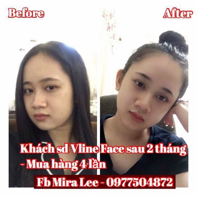 Tinh Chất Thon Gọn Mặt V- Line Miracle