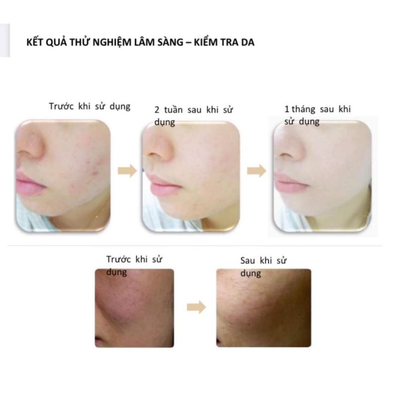 Toner BHA 2% LUMIDER