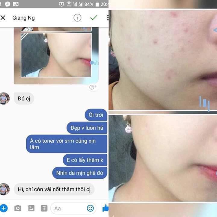 Bộ 4 Sản Phẩm Làm Sạch Da, Giảm Mụn Và Thâm Caryophy (Tẩy trang 300ml + Sữa rửa mặt 150ml + Toner 300ml + Serum 10ml | BigBuy360 - bigbuy360.vn