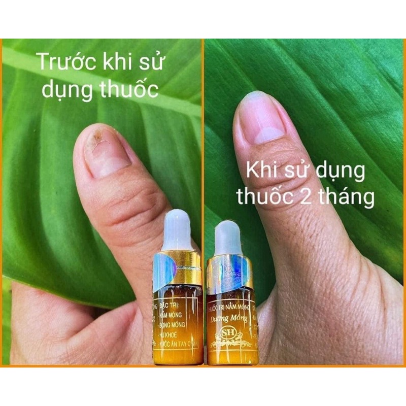 phục hồi móng hư tổn