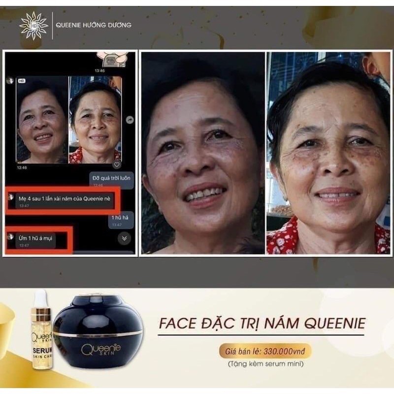 FACE_ĐẶC_TRỊ_NAM_DƯỠNG_TRẮNG_DA_QUEENIE _SkIN