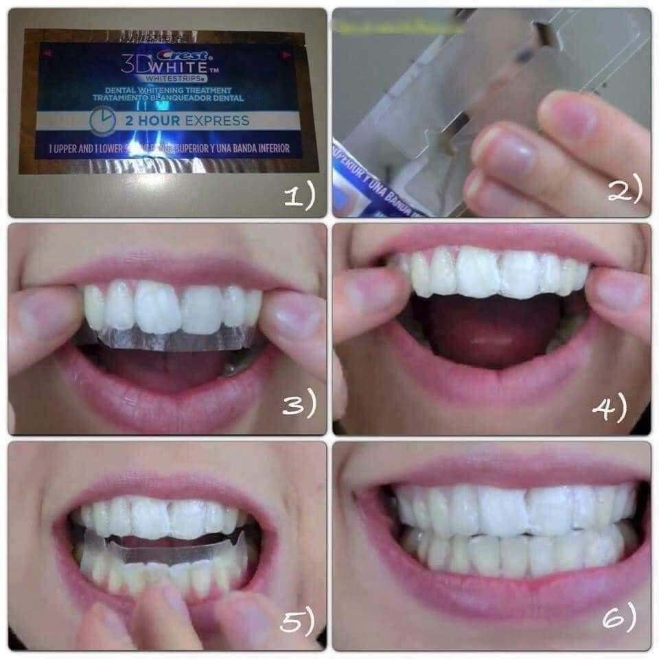 Miếng dán răng Crest 3D 1 HỘP 4 PACK ( CÓ SẴN)