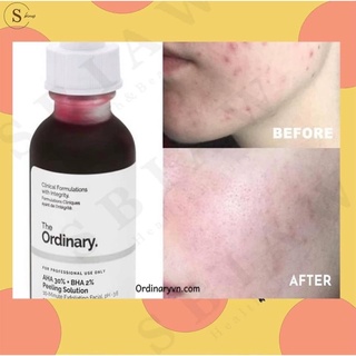 Serum tẩy da chết The Ordinary AHA 30% + BHA 2% Peeling Solution 30ml