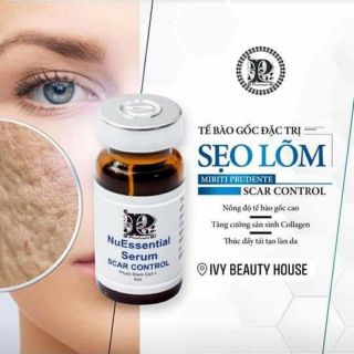 Tế bào gốc làm đầy sẹo rỗ, sẹo lõm Scar Control