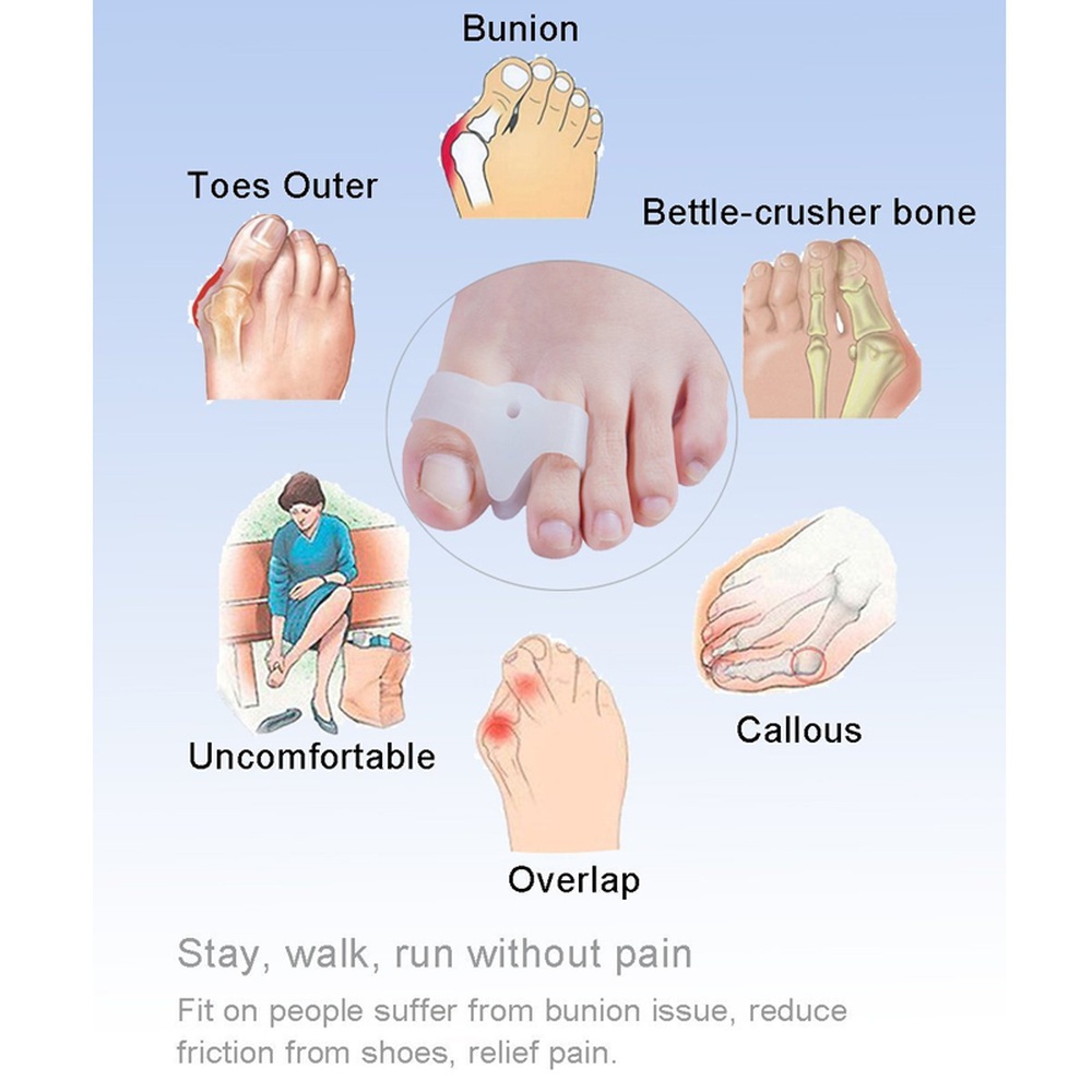 [Hàng mới về] Gel điều chỉnh hình ngón chân cái