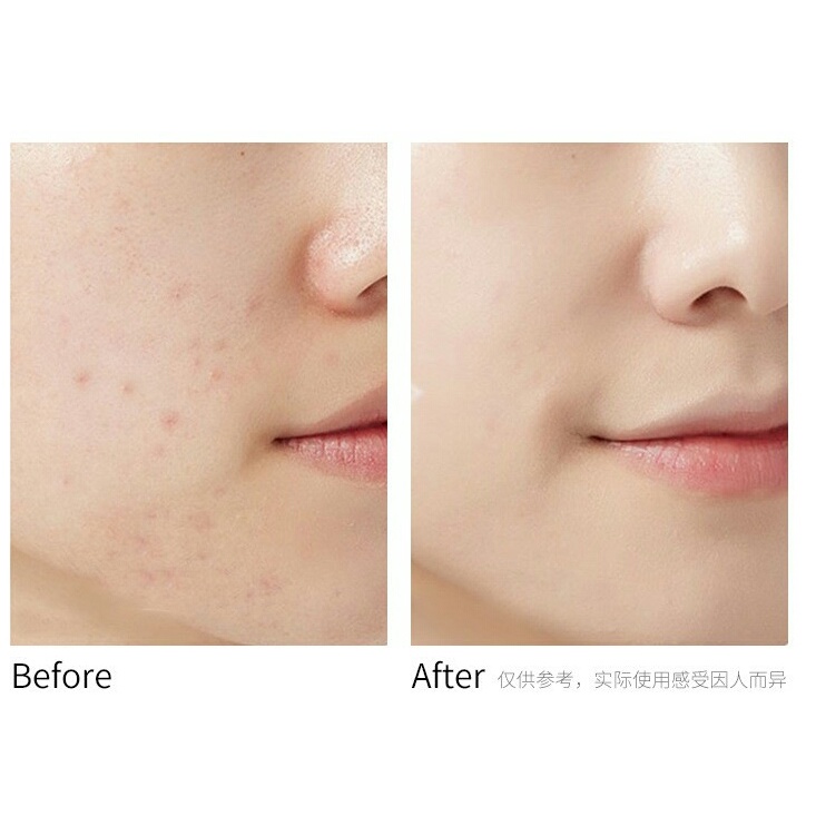 Phấn Nước Air Cushion BB Lameila Chiếc ô màu xanh - Giúp Gương Mặt Đẹp Không Tì Vết