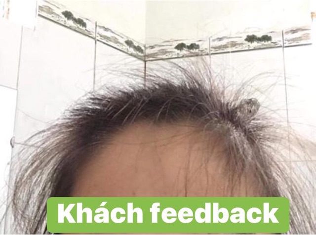 Tinh Dầu Bưởi Dưỡng Tóc Thuỷ Mộc Dạng Xịt Ngăn Rụng Tóc Kích Mọc Tóc Dài Dùng Được Cho Người Ít Tóc Hói Đầu | BigBuy360 - bigbuy360.vn