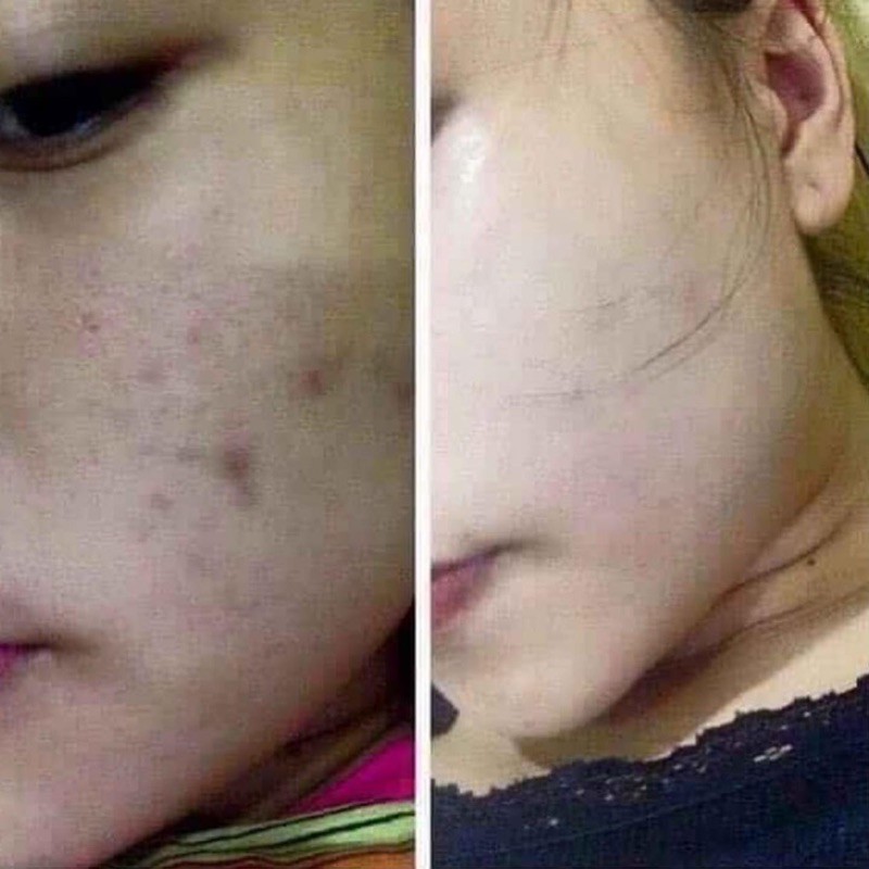 Tinh dầu Tea Tree Oil The Body Shop | BigBuy360 - bigbuy360.vn