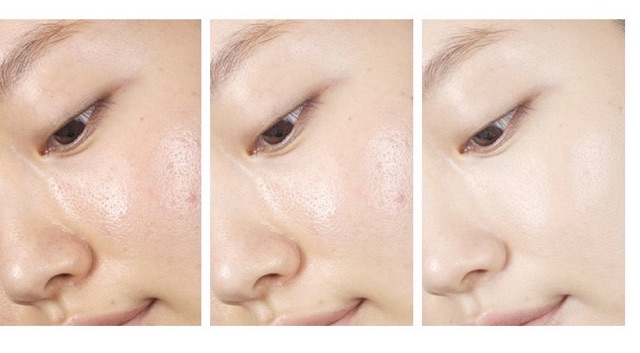 Tinh Chất Feotznw Cứu Tinh cho làn da