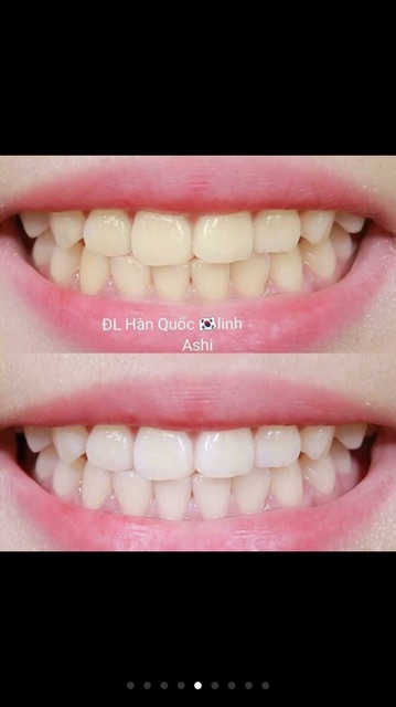 Bột trắng răng Ashi sale