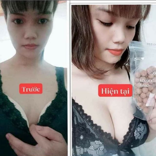 Kẹo mầm tăng size vòng 1 to săn chắc