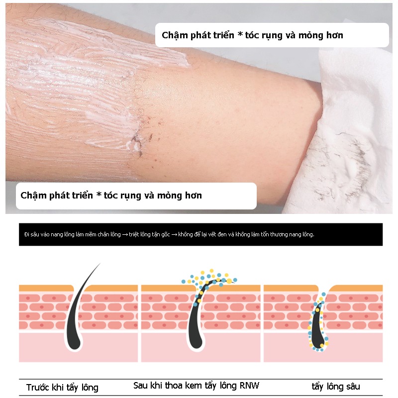 Kem Tẩy Lông Rnw Dịu Nhẹ Không Gây Kích Ứng Cho Vùng Da Dưới Cánh Tay Và Chân Cho Nam Nữ 120g
