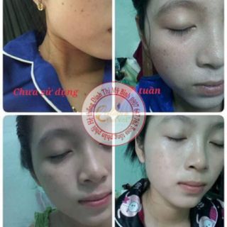 collagen plus vit e