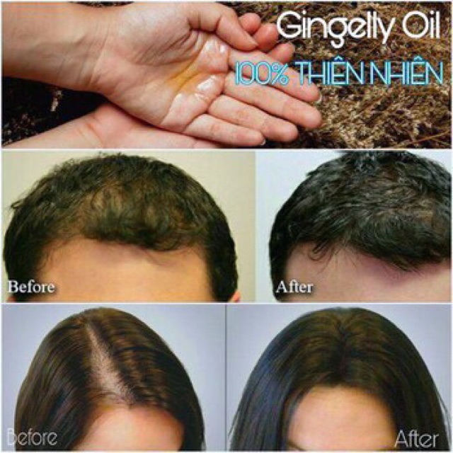 Tinh Dầu Gingelly Oil Giúp Mọc Tóc , Mọc lông Mày và Mọc Lông Mi