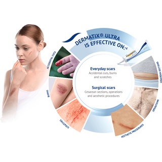 Hỗ trợ mờ sẹo Dermatix Ultra - Amipharma