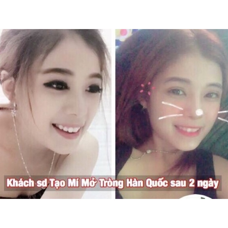 Tinh chất Miracle Pháp tạo mắt 2 mí, mở tròng mắt siêu hiệu quả (10ml)