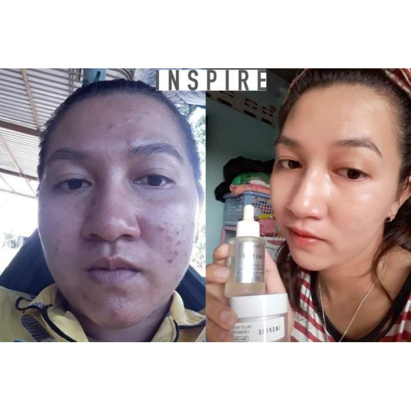 ❤FREESHIP❤SERUM TINH CHẤT CĂNG BÓNG PHỤC HỒI DA INSPIRE AMPUOLE (MUA 1 TẶNG 1)