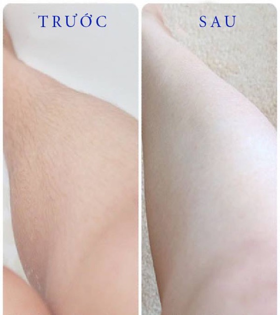 Kem tẩy lông VEET 100ml ( Pháp ) Tẩy lông 3-6 phút dành cho da thường | BigBuy360 - bigbuy360.vn