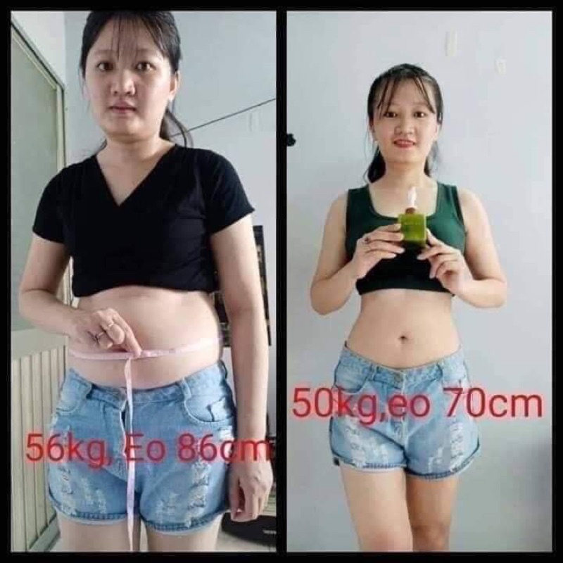 Kem tan mỡ bụng Go.slim (tặng kèm nịt bụng)