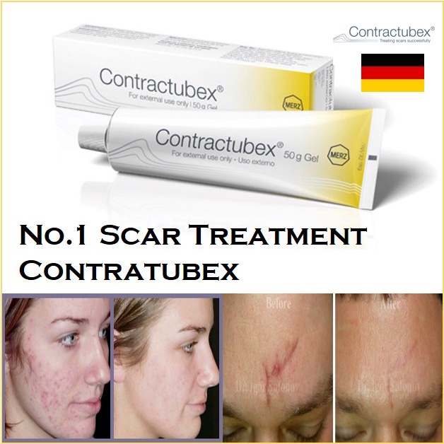 Kem sẹo Contractubex mờ sẹo lồi và ngừa sẹo 30g