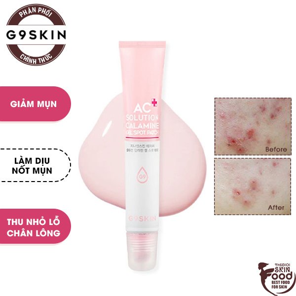 Kem Dưỡng Hỗ Trợ Giảm Mụn Giúp Giảm Sưng, Làm Dịu Nốt Mụn G9Skin AC Solution Calamine Gel Spot Patch 20g