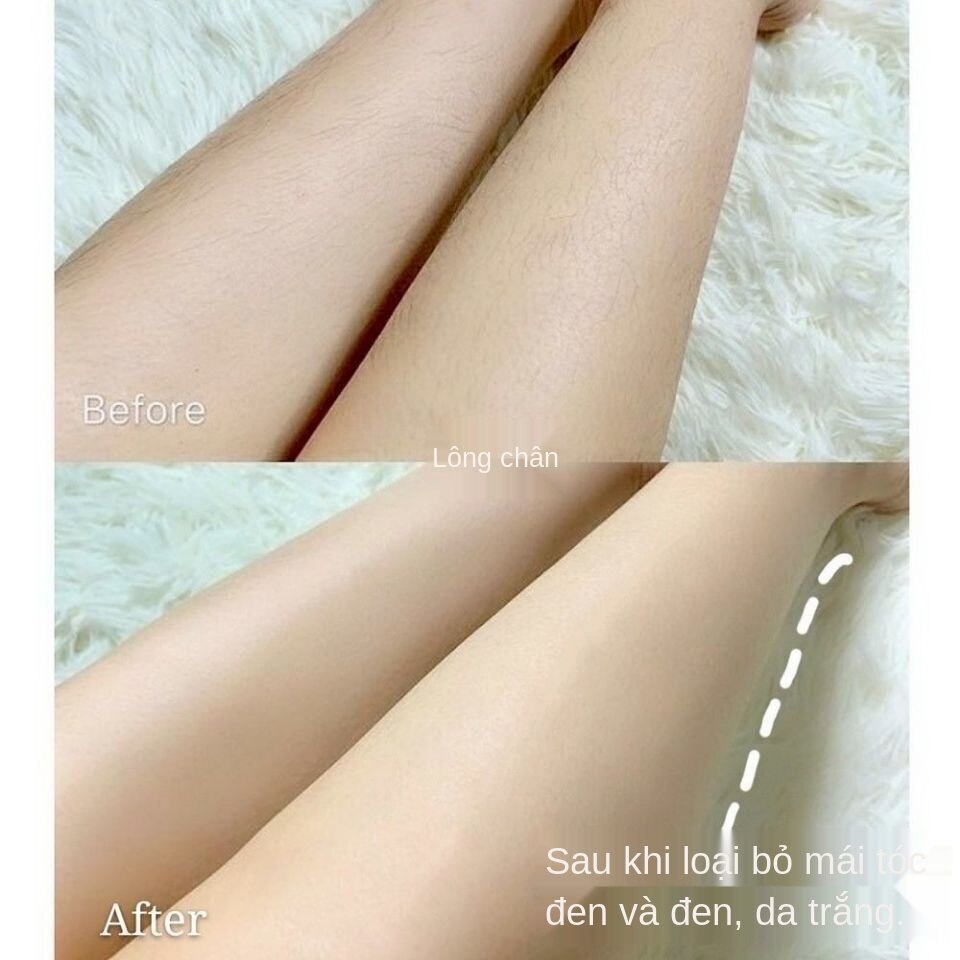 Kem Tẩy Lông Hiệu Quả Rất Tốt. Không Đau Toàn Thân Kem Tẩy Lông Nữ Sinh Viên Tư Nhân Chân Ria Mép Môi Nam Giới Và Phụ Nữ Yongchao Lâu | BigBuy360 - bigbuy360.vn