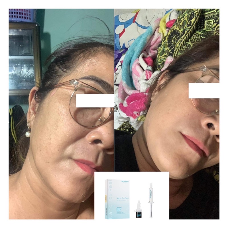 PEEL DA VI TẢO NANO GIÚP LOẠI BỎ LÀN DA KHÔ XẠM TRỞ NÊN MỀM MẠI