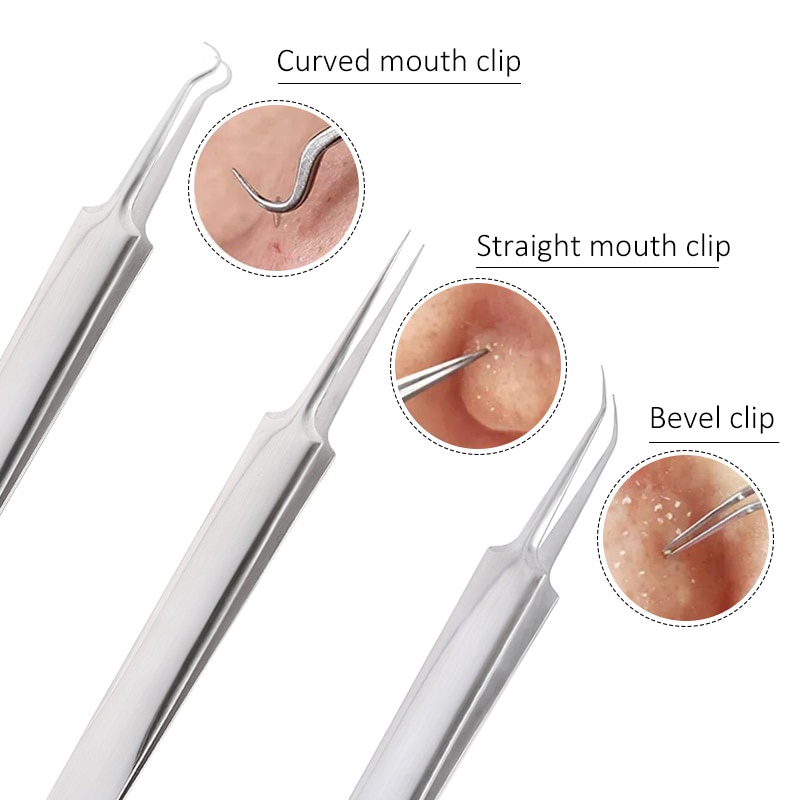 3 đầu tóc đen Comedone Đốm đen vùng khuyết tật mụn giày da để chăm sóc việc điều trị da phụ nữ để làm sạch mụn trứng cá ngoài lỗ chân cá