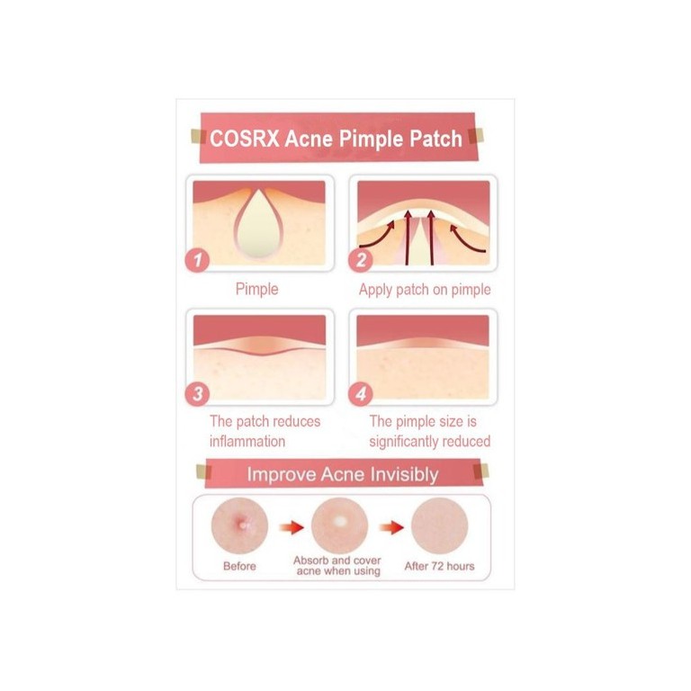 Miếng dán mụn Cosrx Acne Pimple Master Patch