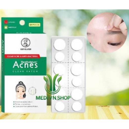 Miếng Dán Mụn - Giúp Giảm Mụn Sưng Viêm (Hộp 24 Miếng)