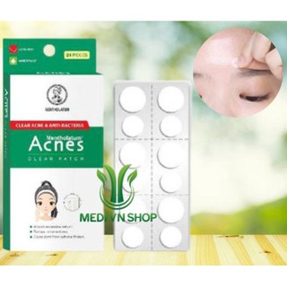 Miếng dán mụn - giúp giảm mụn sưng viêm