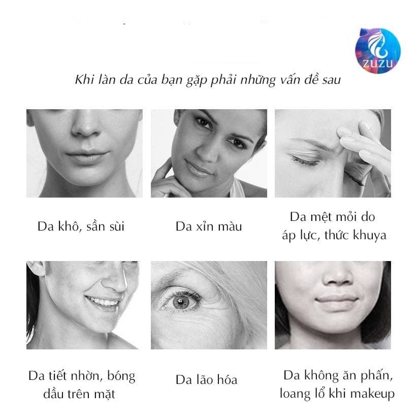 Tinh chất Hyaluronic Acid dạng viên nang dưỡng ẩm thu nhỏ lỗ chân lông nuôi dưỡng và phục hồi làn da